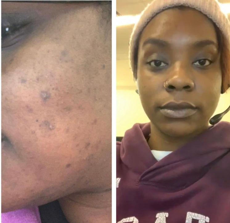 Topical Boost Omega Glow Oil